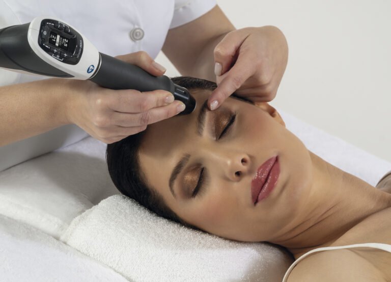 Storz Medical shockwave Wrinkle Treatment